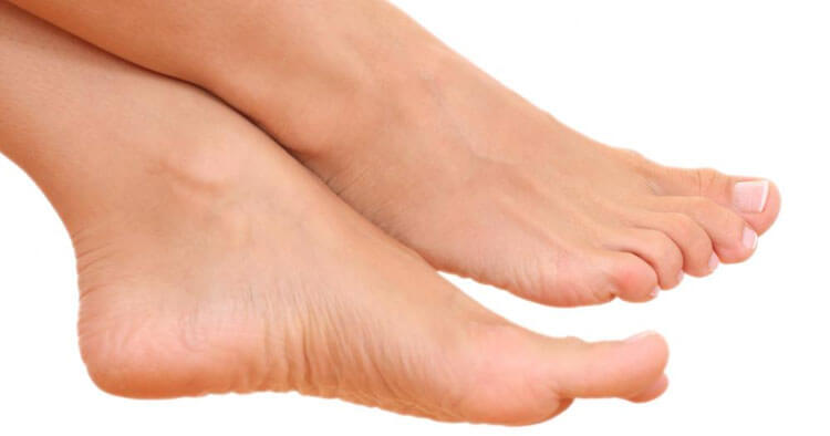 Plantar Fasciitis A Common Cause Of Heel Pain