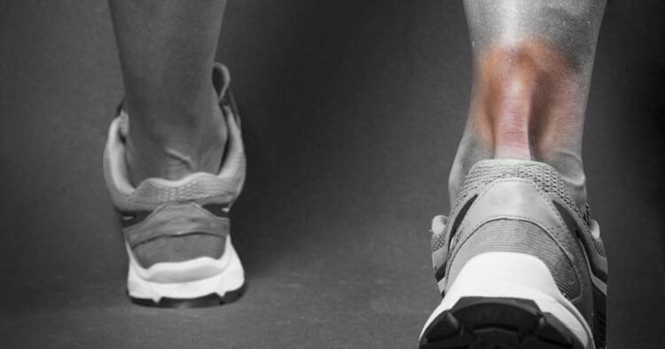 Treating Achilles Pain The Physiotherapy Way