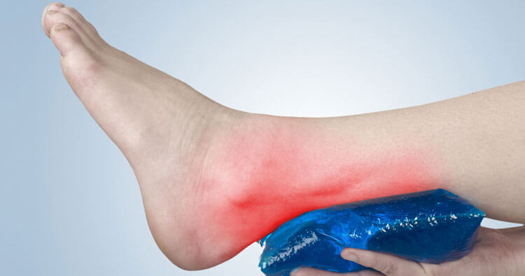 What's Causing My Achilles Tendon Pain?