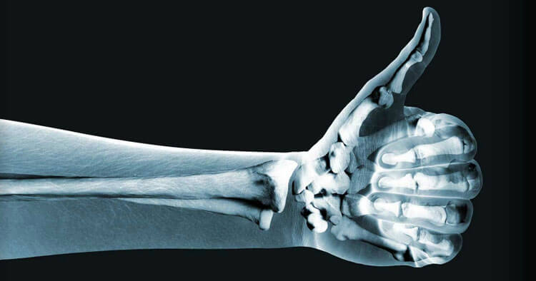 Musculoskeletal Imaging And Physiotherapy