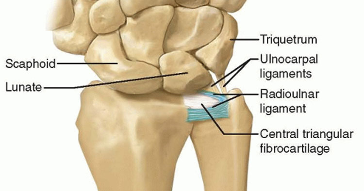 Treatment Options For TFCC Tears