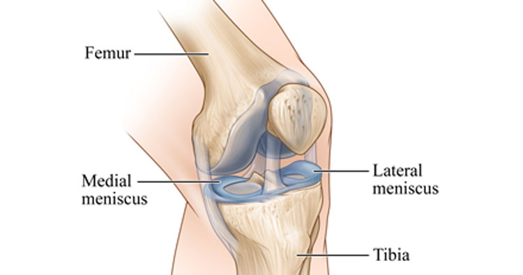 What Is The Knee Meniscus?