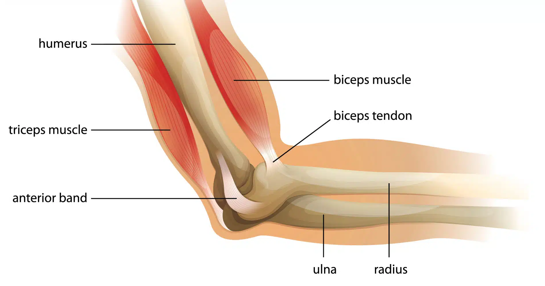 Anterior Elbow Pain From Biceps Tendinopathy